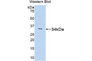 Image no. 1 for anti-Tissue Factor Pathway Inhibitor (Lipoprotein-Associated Coagulation Inhibitor) (TFPI) (AA 29-302) antibody (ABIN1078584)