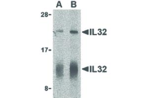 Image no. 1 for anti-Interleukin 32 (IL32) (C-Term) antibody (ABIN6655809)
