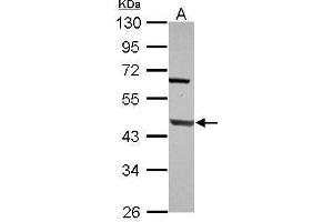 Image no. 1 for anti-Polymerase (DNA Directed), beta (POLB) (Center) antibody (ABIN2855571)