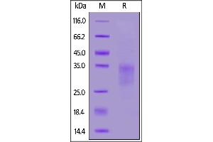 Image no. 2 for CD7 (CD7) (AA 26-180) (Active) protein (His tag,AVI tag,Biotin) (ABIN6973016)