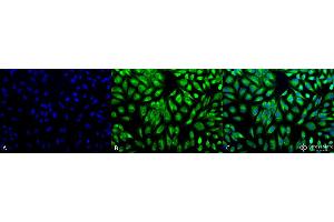 Image no. 1 for anti-Prolyl 4-Hydroxylase, beta Polypeptide (P4HB) (AA 409-509) antibody (HRP) (ABIN2486777)