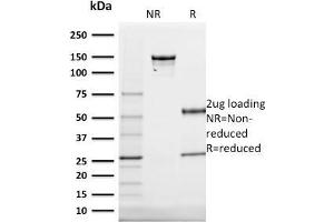 Image no. 5 for anti-Keratin 20 (KRT20) (AA 196-323) antibody (ABIN6940346)