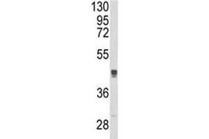 Image no. 2 for anti-Trans-Golgi Network Protein 2 (TGOLN2) (AA 399-427) antibody (ABIN3029193)