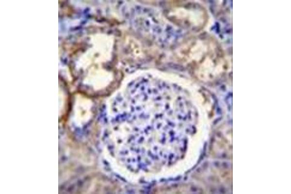 anti-Family with Sequence Similarity 96, Member A (FAM96A) (AA 116-146), (C-Term) antibody