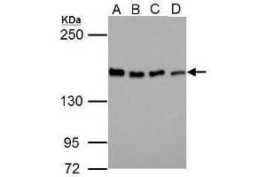 WB Image Sample (30 ug of whole cell lysate)    A: Jurkat   B: Raji   C: K562   D: NCI-H929   5% SDS PAGE    antibody diluted at 1:1000   