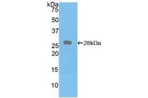 PKD2 Antikörper  (AA 621-832)