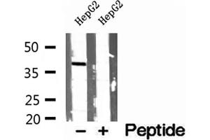 Image no. 2 for anti-Peroxisomal Biogenesis Factor 16 (PEX16) (Internal Region) antibody (ABIN6264149)