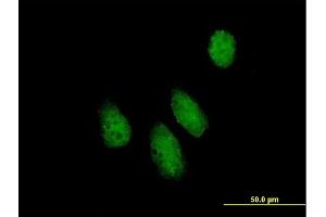 Image no. 1 for anti-Nucleoporin Like 1 (NUPL1) (AA 1-599) antibody (ABIN523249)