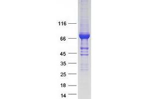 Image no. 1 for Sec23 Homolog B (SEC23B) (Transcript Variant 1) protein (Myc-DYKDDDDK Tag) (ABIN2731571)
