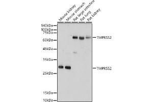 TMPRSS2 Antikörper  (AA 140-400)