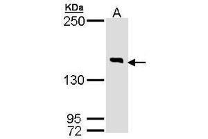 Image no. 2 for anti-DIP2 Disco-Interacting Protein 2 Homolog B (DIP2B) (C-Term) antibody (ABIN2856736)