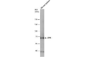 Image no. 9 for anti-Spleen tyrosine Kinase (SYK) (Internal Region) antibody (ABIN2854855)