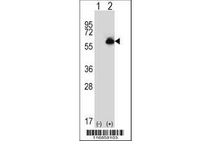 Image no. 3 for anti-Aldehyde Dehydrogenase 4 Family, Member A1 (ALDH4A1) (AA 533-561), (C-Term) antibody (ABIN392356)