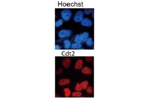 Image no. 3 for anti-Denticleless E3 Ubiquitin Protein Ligase Homolog (DTL) (C-Term) antibody (ABIN2451940)