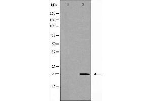 Image no. 1 for anti-Receptor (G Protein-Coupled) Activity Modifying Protein 2 (RAMP2) (Internal Region) antibody (ABIN6266266)