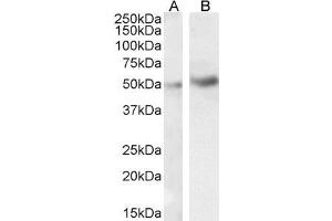 Image no. 4 for anti-Interleukin-1 Receptor-Associated Kinase 4 (IRAK4) (N-Term) antibody (ABIN185338)