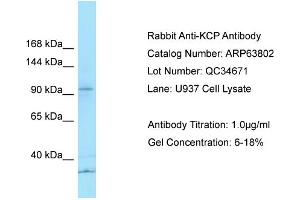 Image no. 1 for anti-Kielin/Chordin-Like Protein (KCP) (N-Term) antibody (ABIN2789631)