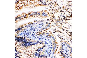 Image no. 1 for anti-Vinculin (VCL) (AA 173-188), (N-Term) antibody (ABIN3044168)