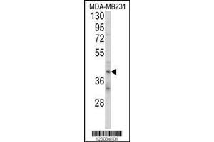 Image no. 1 for anti-Killer Cell Immunoglobulin-Like Receptor, Two Domains, Long Cytoplasmic Tail, 4 (KIR2DL4) (AA 296-323), (C-Term) antibody (ABIN652985)