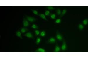 Immunofluorescence analysis of MCF-7 cells using CHAT Polyclonal Antibody