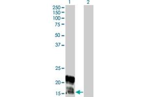 anti-Potassium Voltage-Gated Channel, Isk-Related Family, Member 1 (KCNE1) (AA 67-129) antibody
