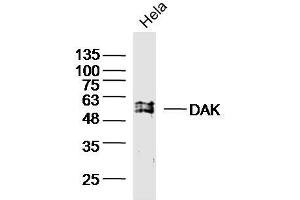 Image no. 1 for anti-Dihydroxyacetone Kinase 2 Homolog (DAK) (AA 101-200) antibody (ABIN5000985)