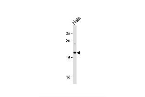 Image no. 1 for anti-NADH Dehydrogenase (Ubiquinone) 1 beta Subcomplex, 10, 22kDa (NDUFB10) (AA 43-70) antibody (ABIN1881570)