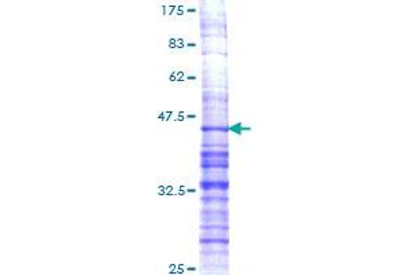 Prodynorphin (PDYN) (AA 147-254) protein (GST tag)