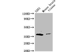 Adenosine A2b Receptor Antikörper  (AA 292-332)