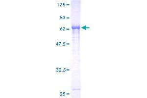 Image no. 1 for Paraneoplastic Antigen MA2 (PNMA2) (AA 1-364) protein (GST tag) (ABIN1315567)