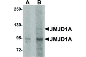 Image no. 1 for anti-Lysine (K)-Specific Demethylase 3A (KDM3A) (N-Term) antibody (ABIN6657024)