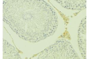 Image no. 3 for anti-Tumor Necrosis Factor Receptor Superfamily, Member 11b (TNFRSF11B) (Internal Region) antibody (ABIN6265637)