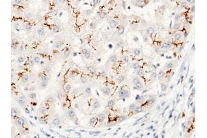 Image no. 2 for anti-Carcinoembryonic Antigen-Related Cell Adhesion Molecule 1 (Biliary Glycoprotein) (CEACAM1) (AA 1-428) antibody (ABIN1997555)
