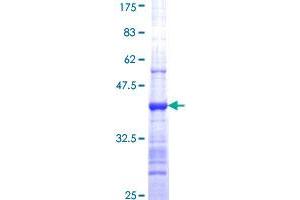 Image no. 1 for Protein Arginine Methyltransferase 7 (PRMT7) (AA 88-197) protein (GST tag) (ABIN1316343)