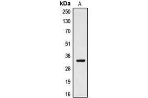 Image no. 2 for anti-Cytochrome B5 Reductase 3 (CYB5R3) (Center) antibody (ABIN2705955)