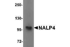 Western blot analysis of NALP4 in K562 cell lysate with NALP4 antibody at 1 µg/mL.