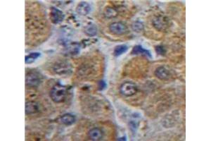 Image no. 3 for anti-alpha Hemoglobin Stabilizing Protein (aHSP) (AA 1-102) antibody (ABIN1172860)