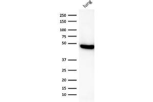 Image no. 1 for anti-Keratin 19 (KRT19) antibody (ABIN6939950)