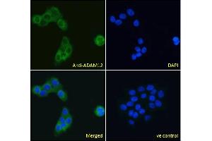 Image no. 2 for anti-ADAM Metallopeptidase Domain 12 (ADAM12) (N-Term) antibody (ABIN185301)