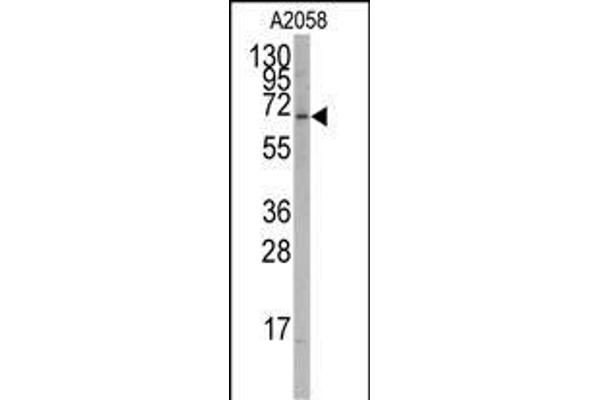 RORA Antikörper  (AA 193-222)