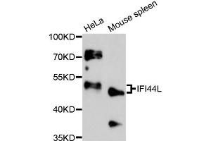Image no. 1 for anti-Interferon-Induced Protein 44-Like (IFI44L) antibody (ABIN6292158)