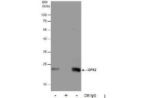 IP Image Immunoprecipitation of GPX2 protein from HepG2 whole cell extracts using 5 μg of GPX2 antibody [C1C3], Western blot analysis was performed using GPX2 antibody [C1C3], EasyBlot anti-Rabbit IgG  was used as a secondary reagent.