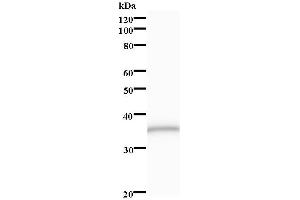 Image no. 1 for anti-Zinc Finger Protein 3 (ZNF3) antibody (ABIN931253)