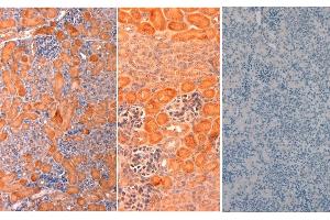 Immunohistochemistry of Rabbit anti-mouse DELTA1 Antibody in Mouse Embryonic Kidney Tissue: Mouse Embryonic Kidney Fixation: FFPE buffered formalin 10% conc Ag Retrieval: Heat, Citrate pH 6.