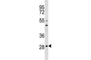 Image no. 2 for anti-Osteoclast Associated Receptor (OSCAR) (AA 205-231) antibody (ABIN3032104)