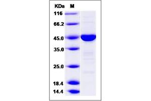 Image no. 1 for rho GTPase Activating Protein 2 (ARHGAP2) (AA 2-459) protein (ABIN2006370)
