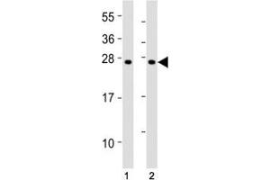 Image no. 5 for anti-Suppressor of Cytokine Signaling 1 (SOCS1) (AA 35-66) antibody (ABIN3029042)