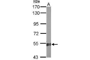 Image no. 4 for anti-Aldehyde Dehydrogenase 1 Family, Member A2 (ALDH1A2) (Center) antibody (ABIN2856988)