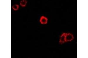 Image no. 1 for anti-Sperm Adhesion Molecule 1 (PH-20 Hyaluronidase, Zona Pellucida Binding) (SPAM1) antibody (ABIN2967057)