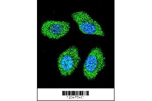 Image no. 4 for anti-Immediate Early Response 3 (IER3) (N-Term) antibody (ABIN2439761)